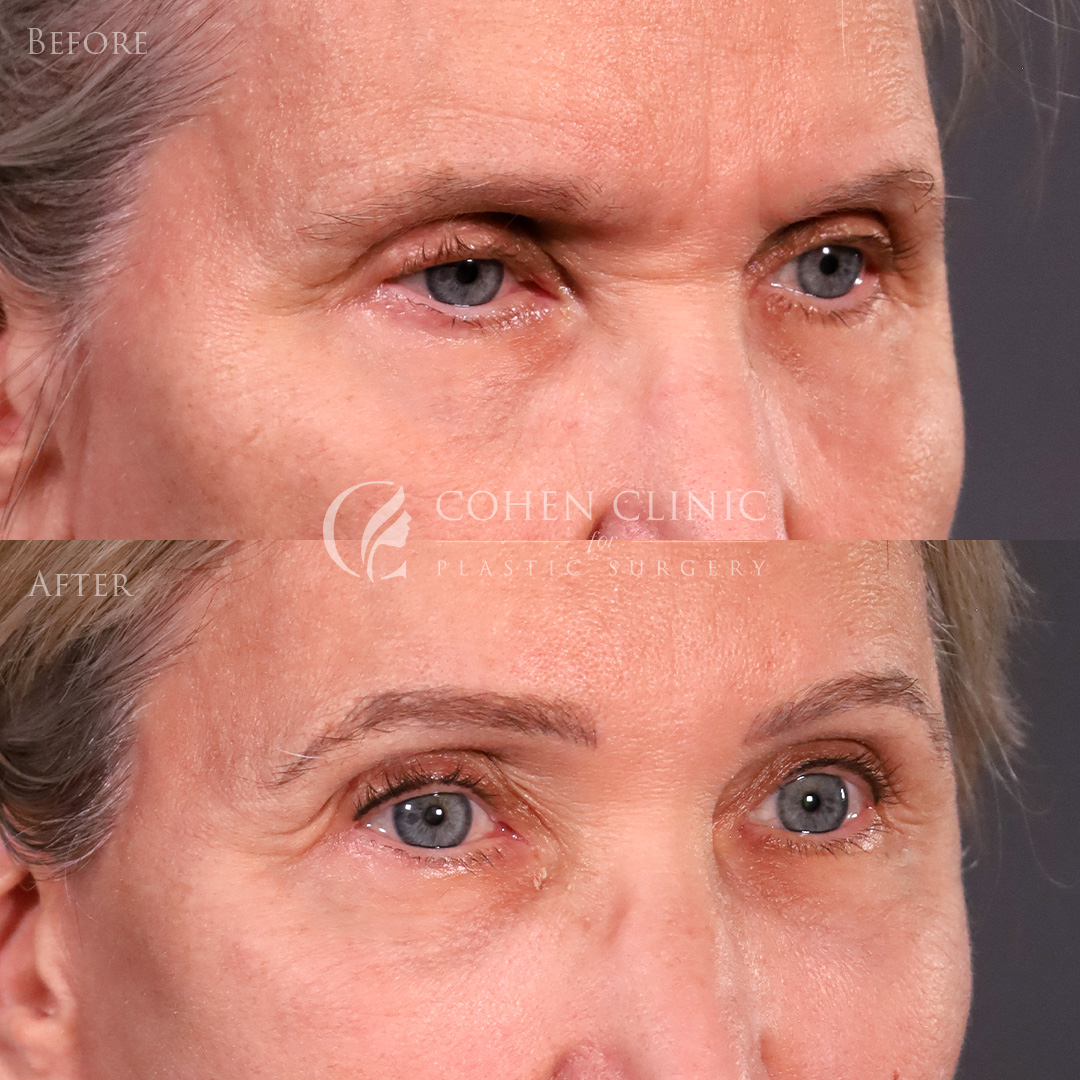 Case 65711 Marge Image