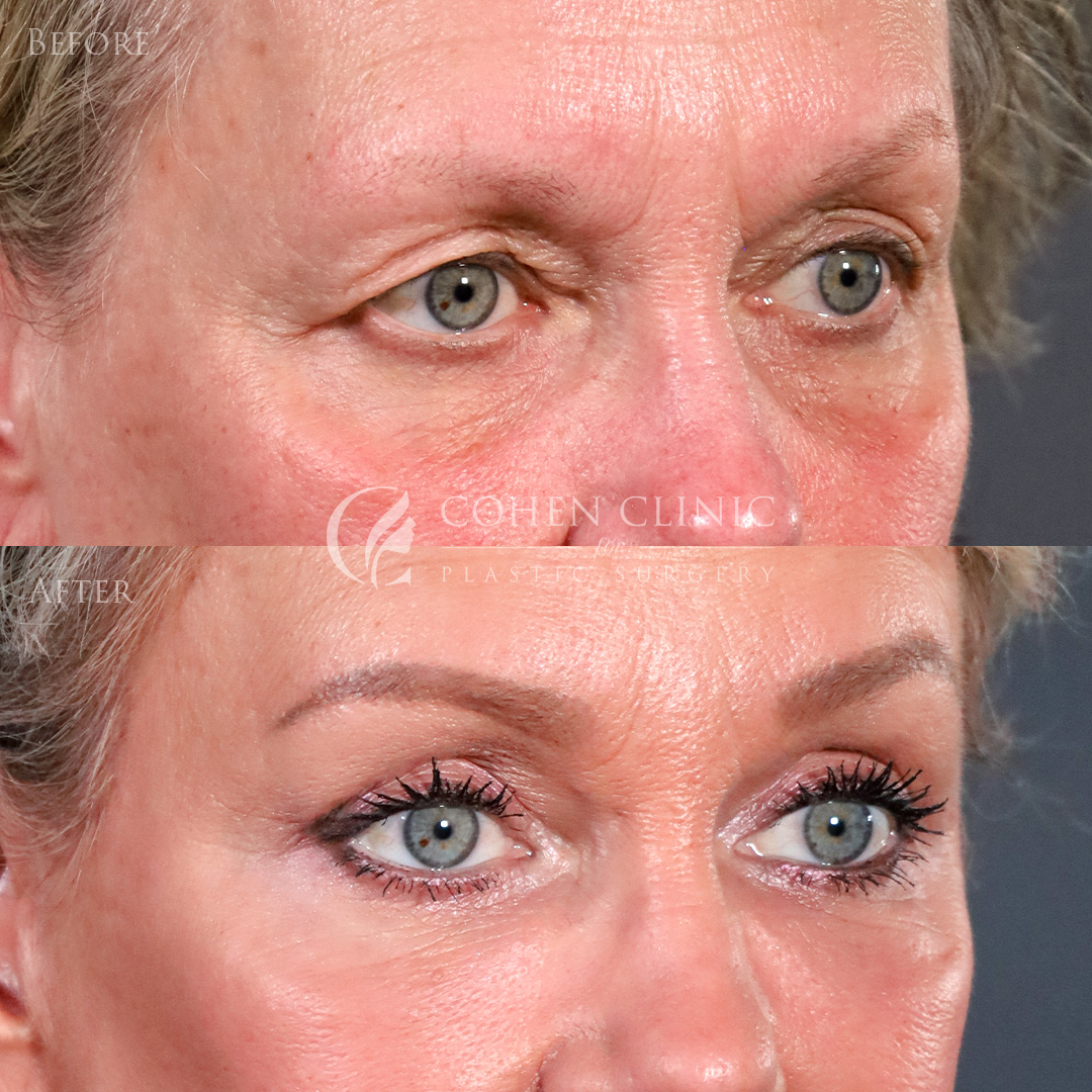 Case 00456 Marge Image