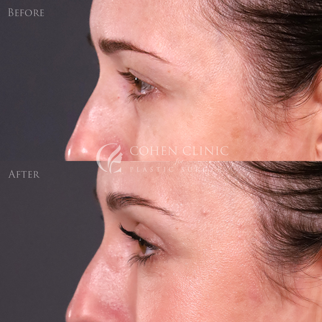 Case 69985 Marge Image