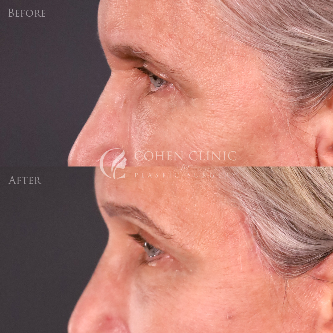 Case 65711 Marge Image