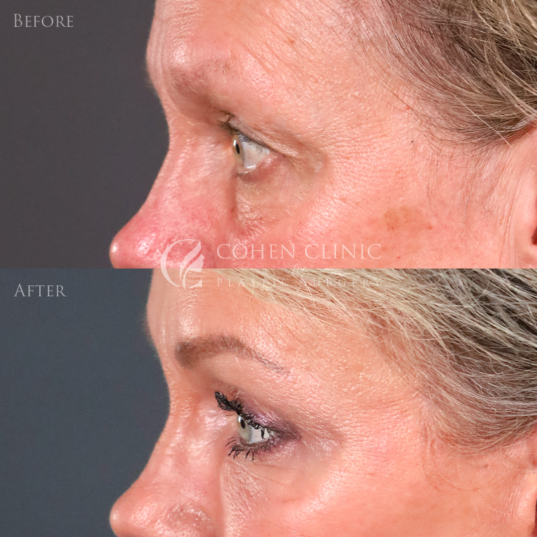 Case 00456 Marge Image