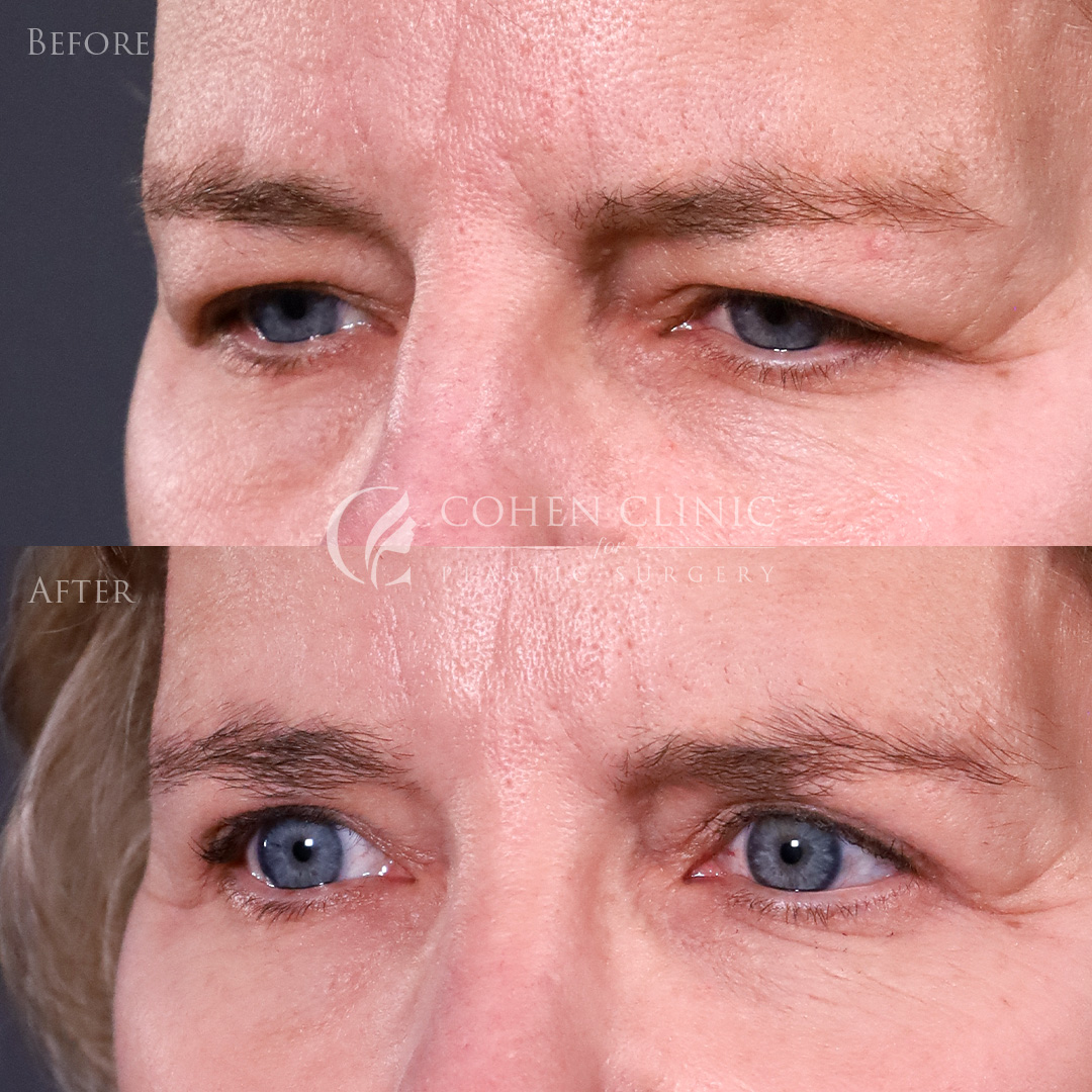 Case 22345 Marge Image