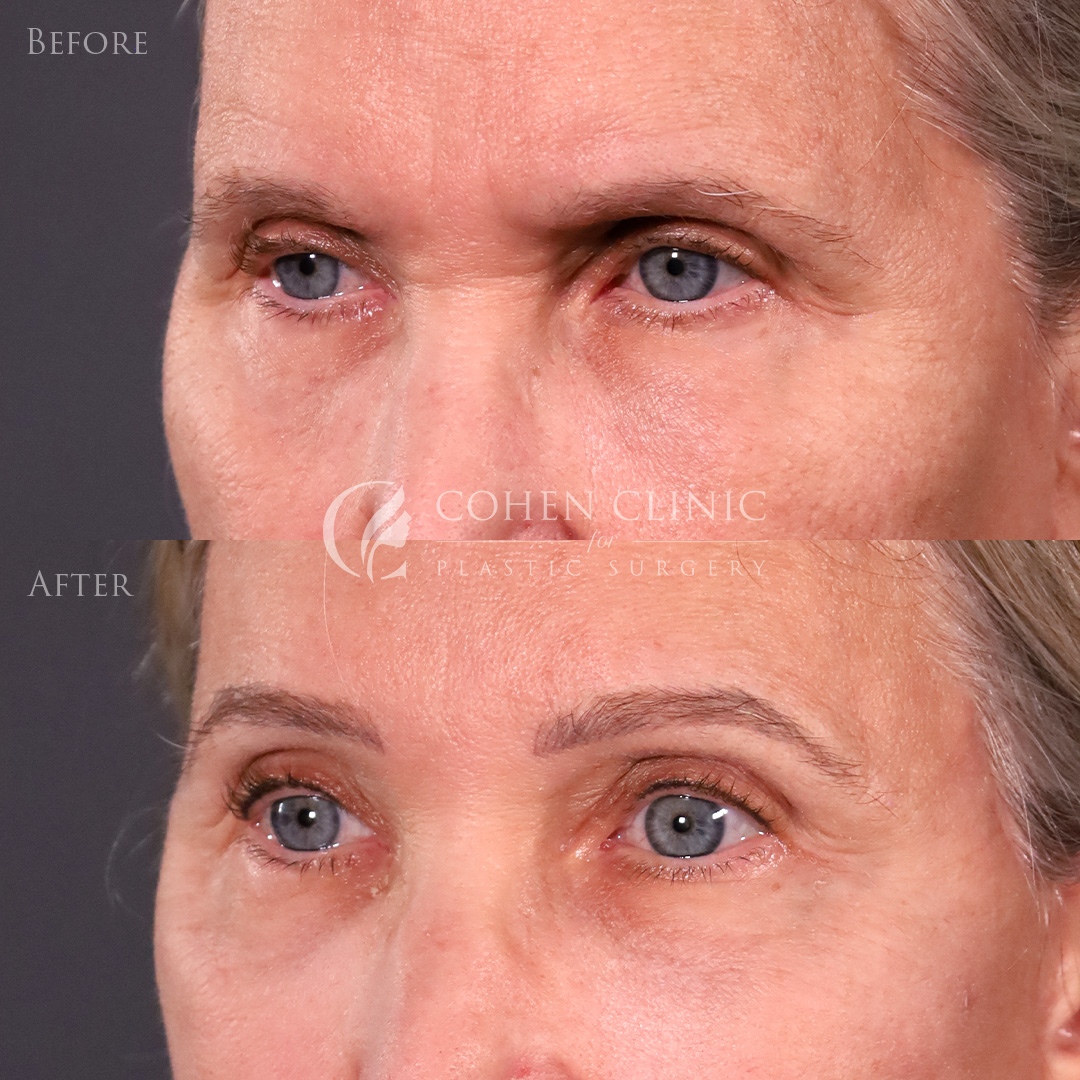 Case 65711 Marge Image