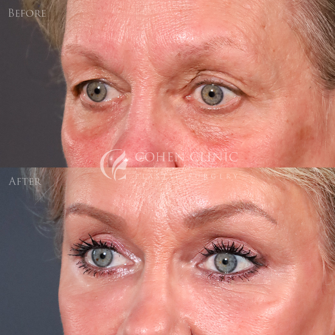 Case 00456 Marge Image