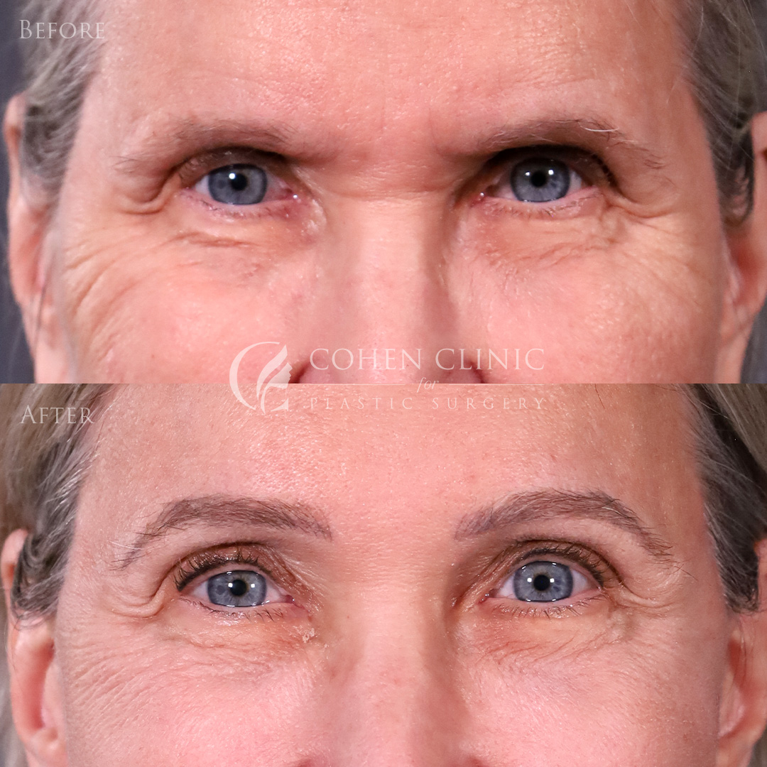 Case 65711 Marge Image