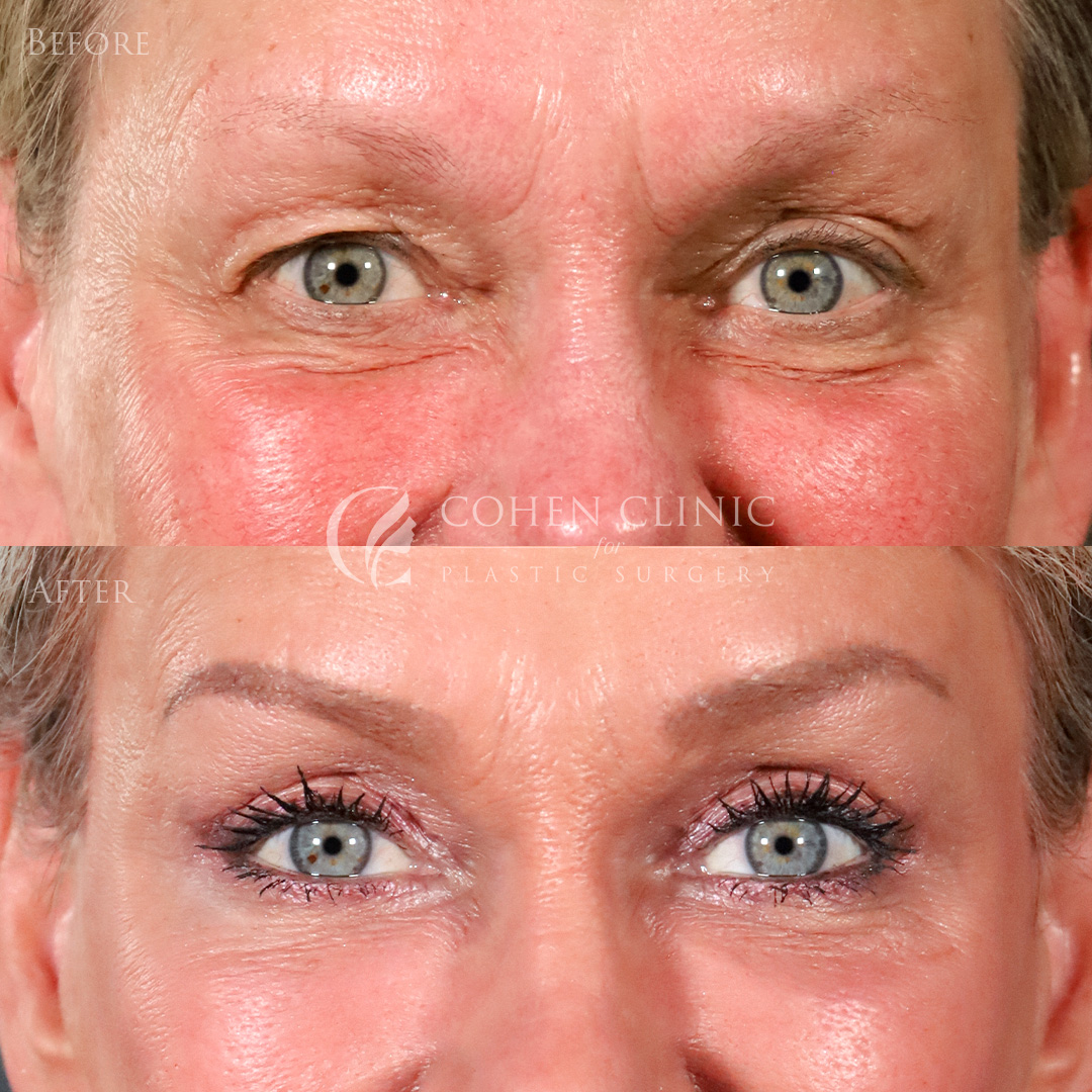 Case 00456 Marge Image