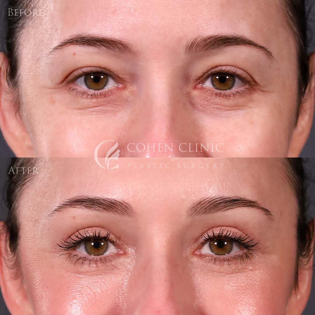 Case 69985 Marge Image