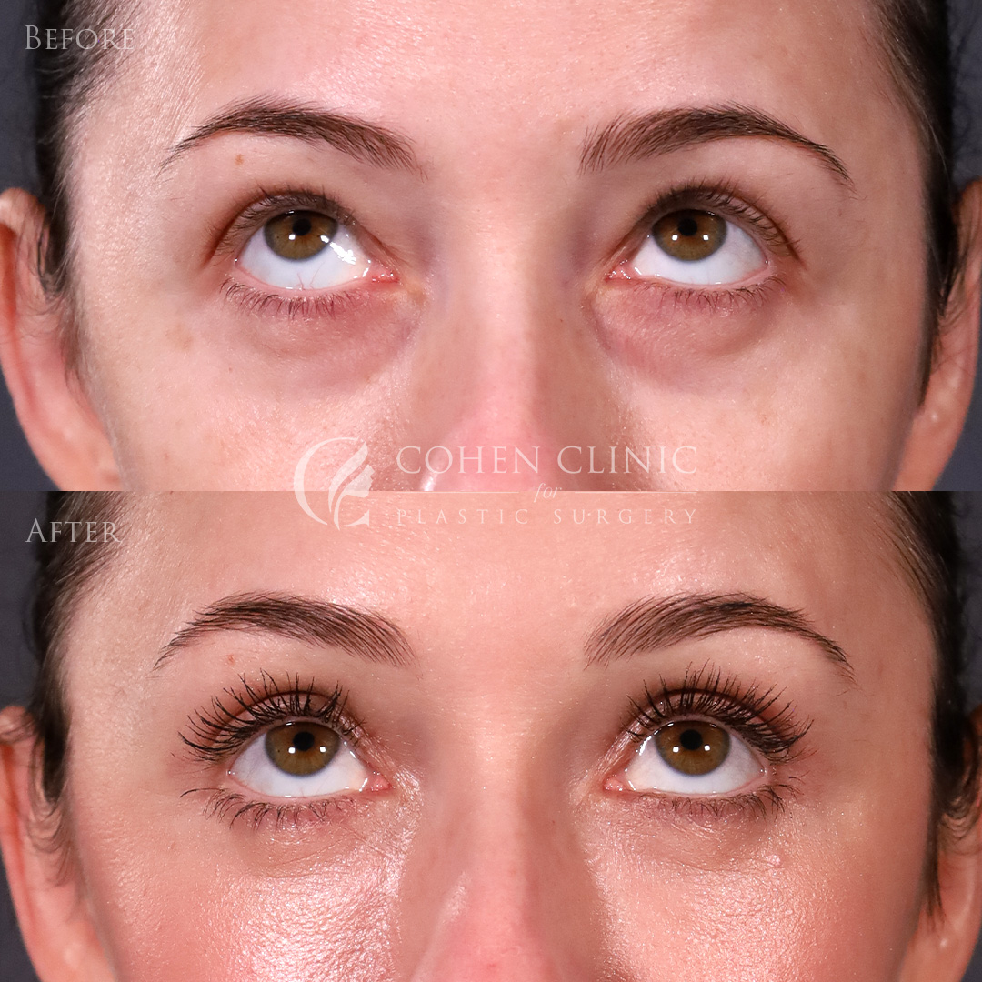 Case 69985 Marge Image