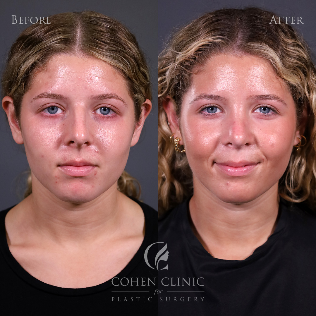Case 00777 Marge Image