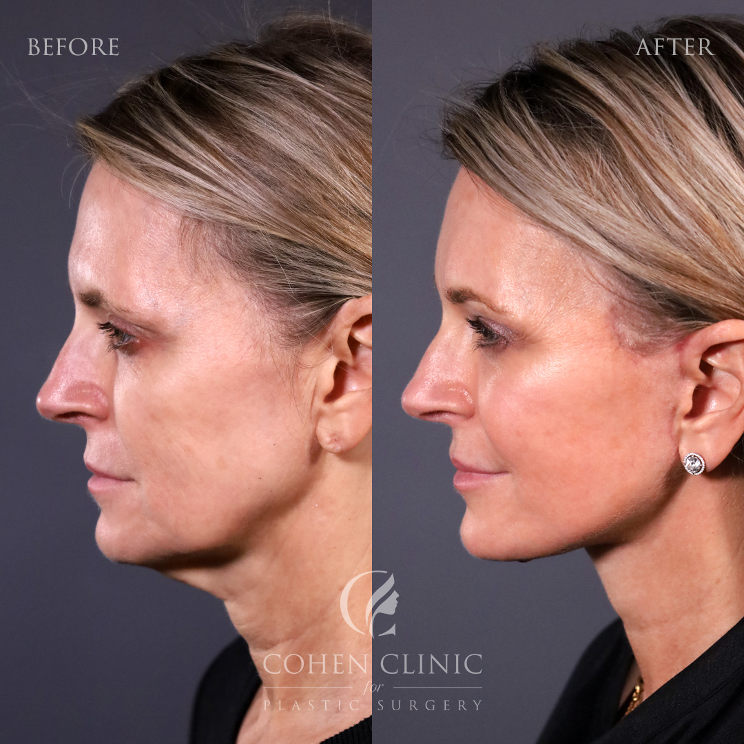 Case 35599 Marge Image