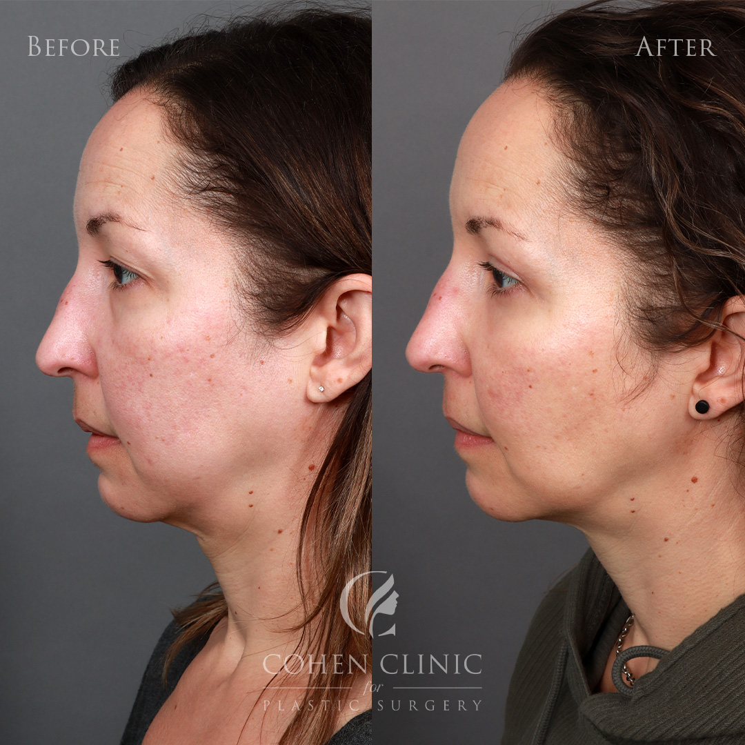 Case 38857 Marge Image