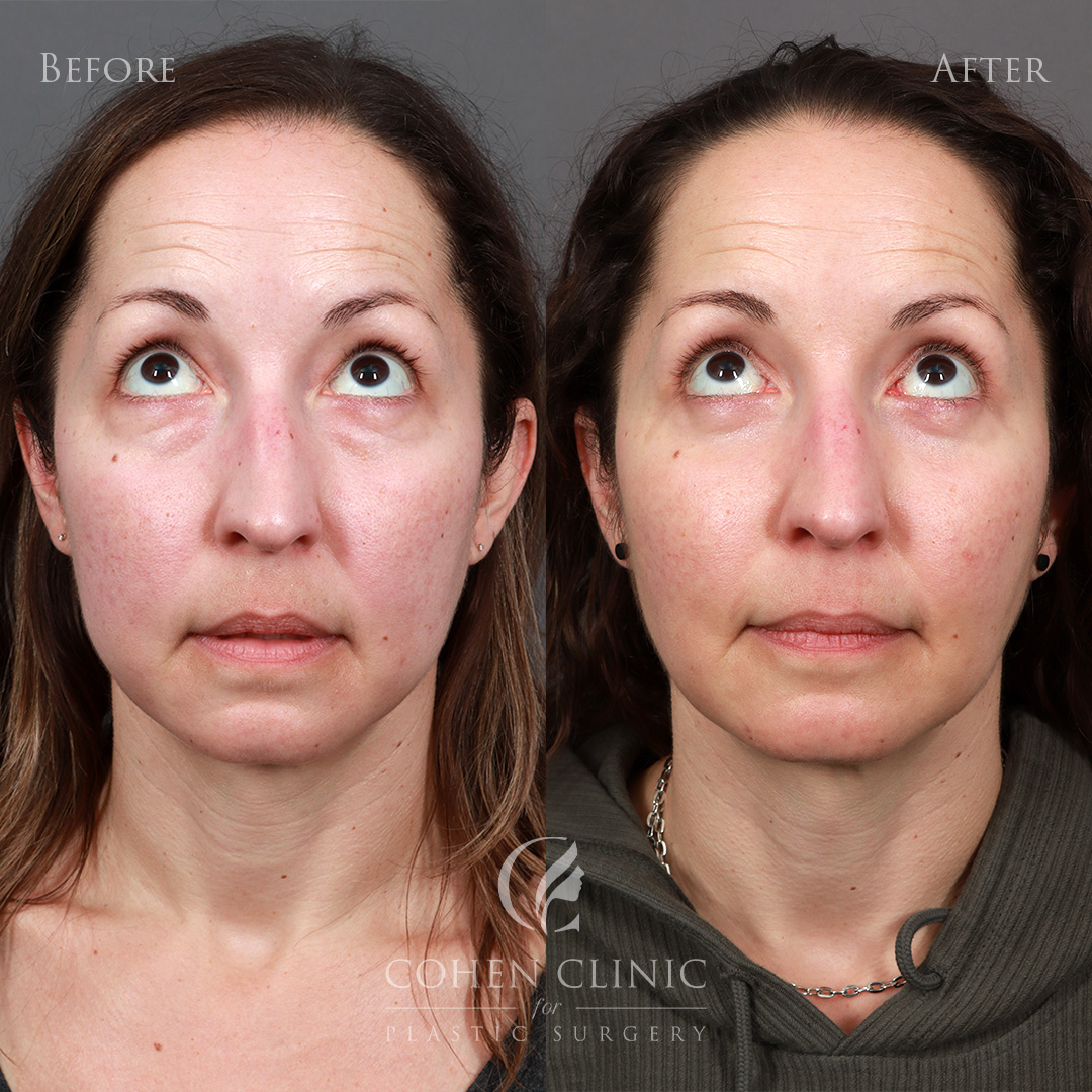 Case 38857 Marge Image