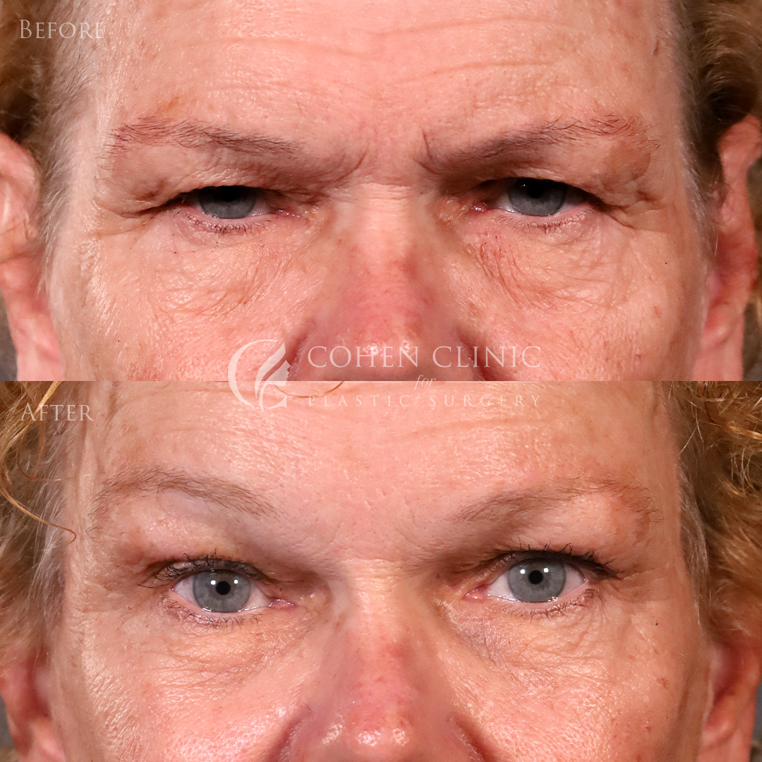 Case 92774 Marge Image
