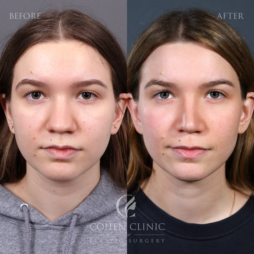Case 47732 Marge Image