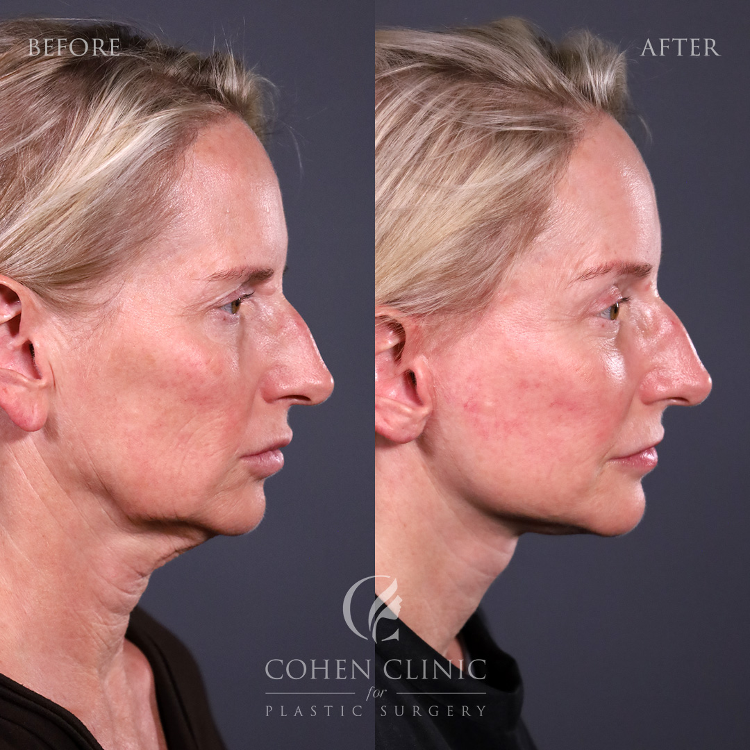 Case 35582 Marge Image