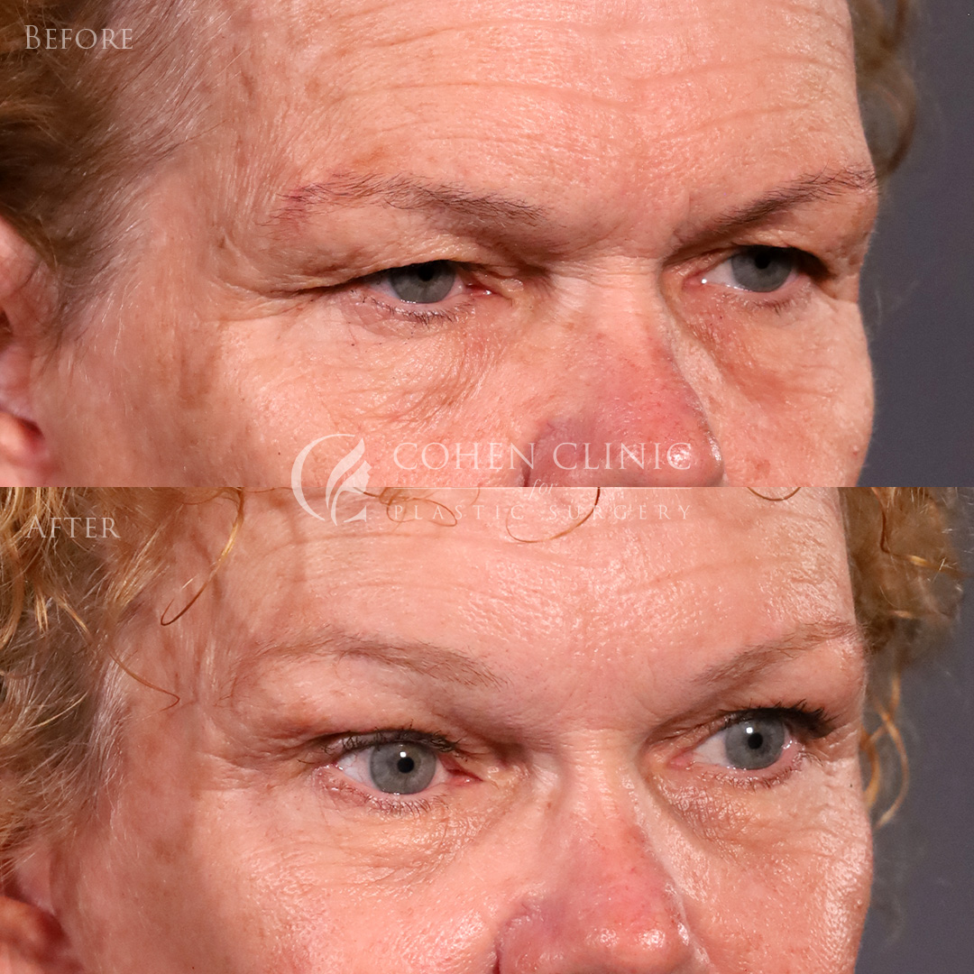 Case 92774 Marge Image