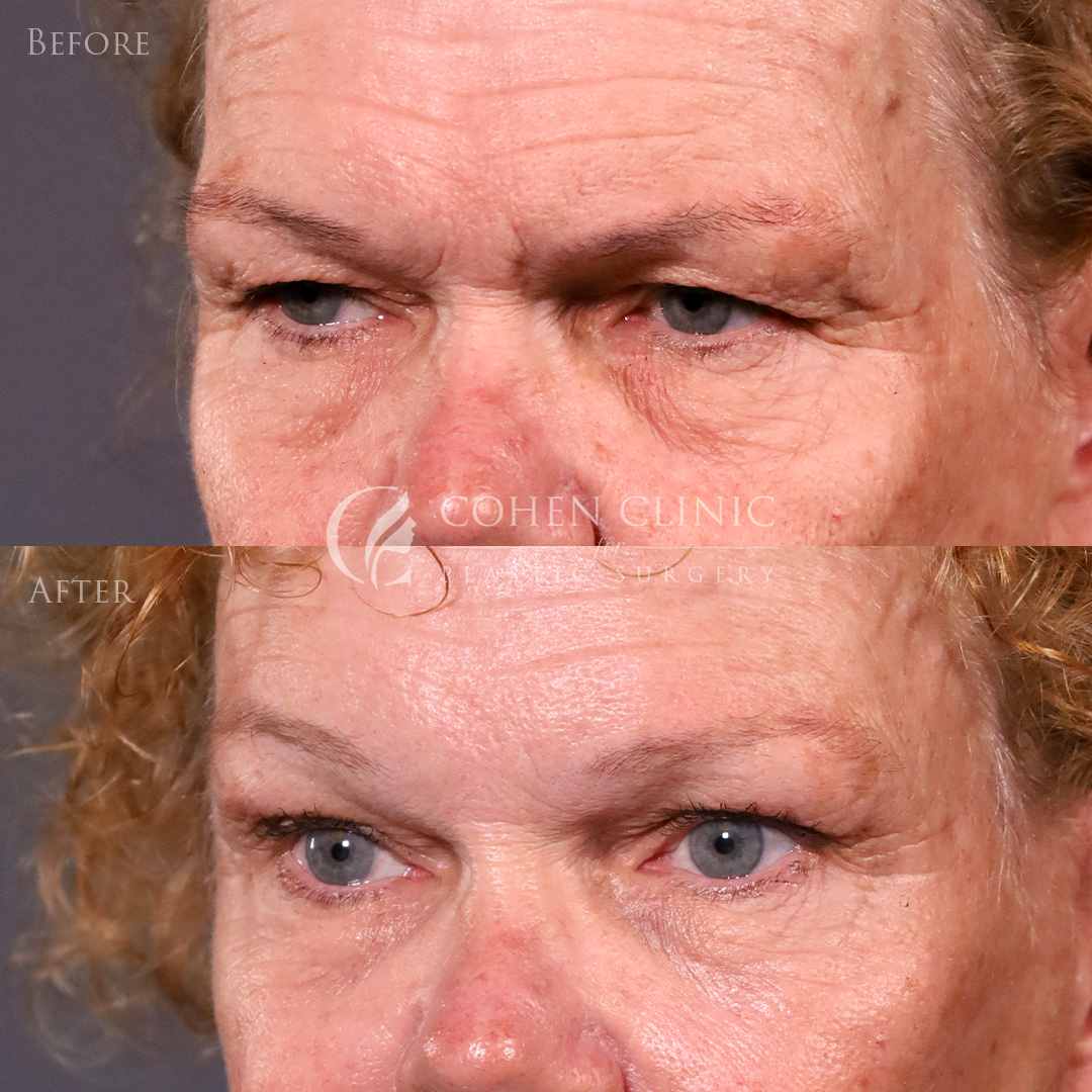 Case 92774 Marge Image