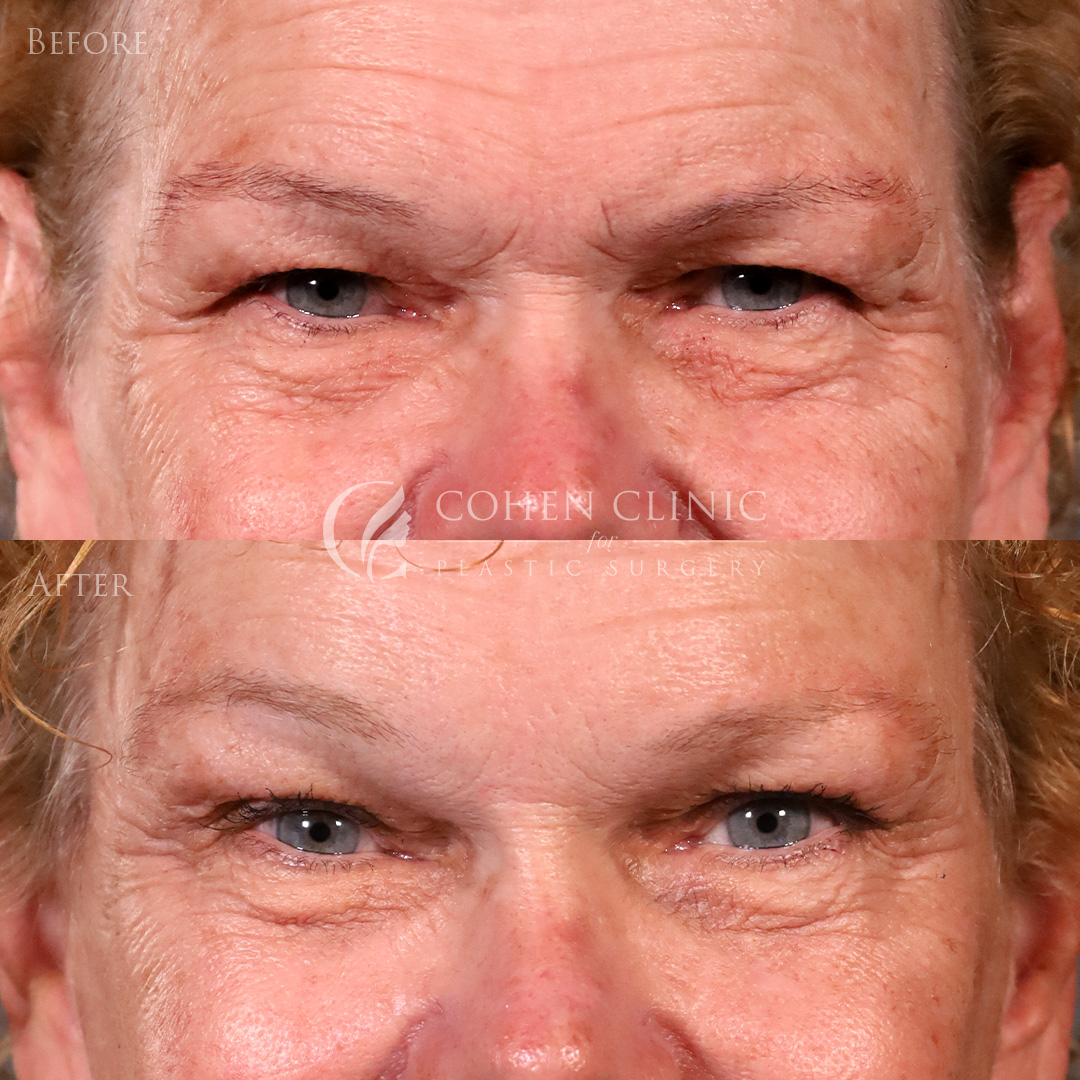 Case 92774 Marge Image